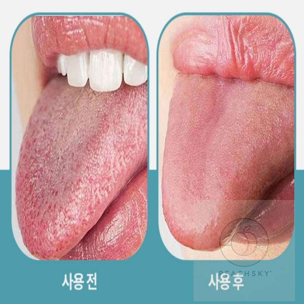 피치스카이 스텐 혀 클리너 혀클리너티타늄 혓바닥 입냄세제거