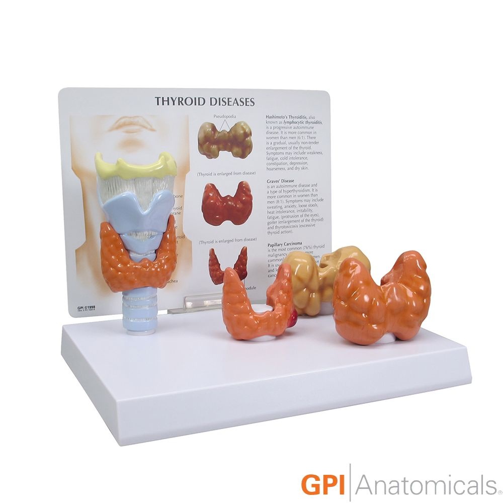 종로의료기상사 갑상선 모형 G315 갑상선 질환