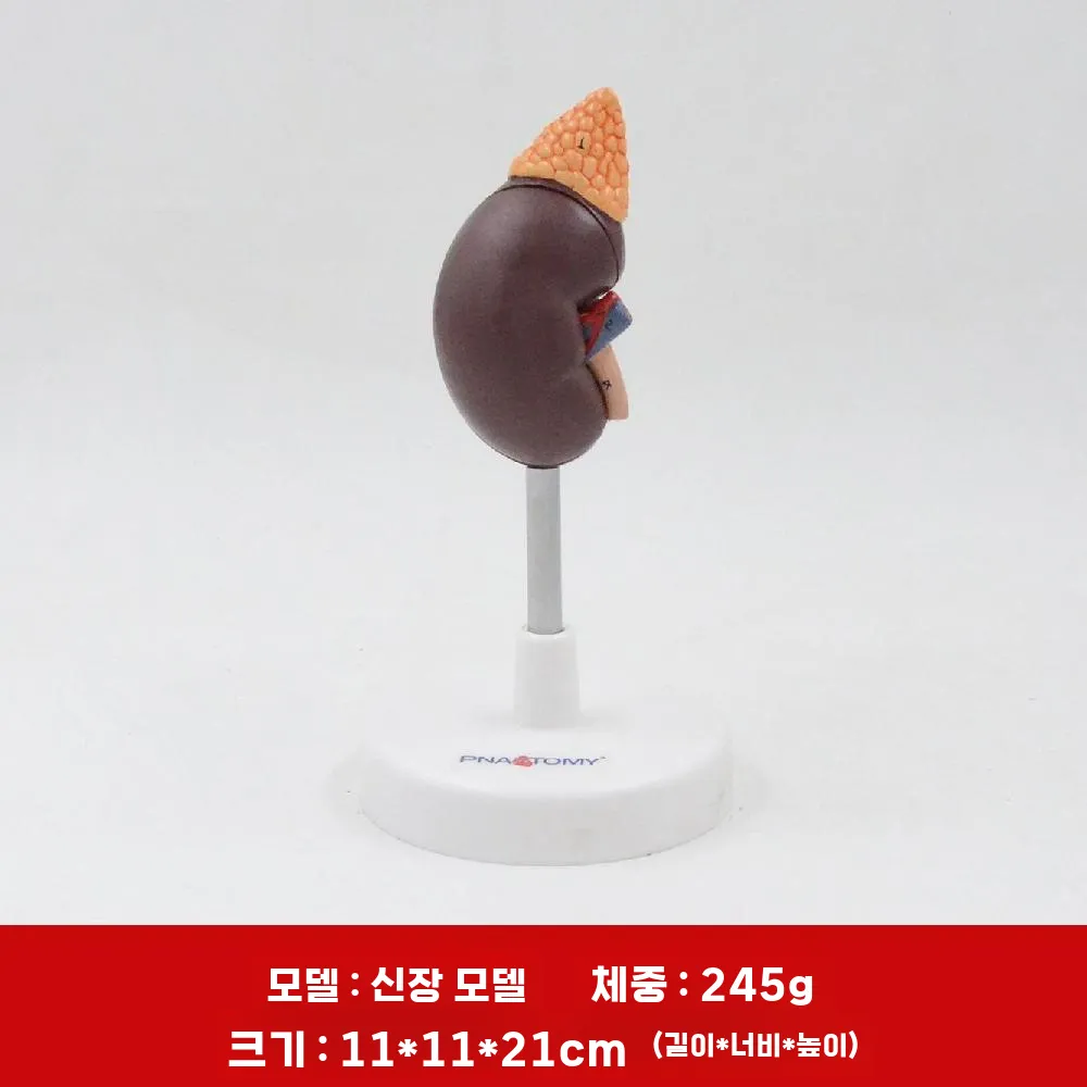 알파블랙 협력사 [해외] 해부학 위 장기 병리학 소화기관 모델 내과
