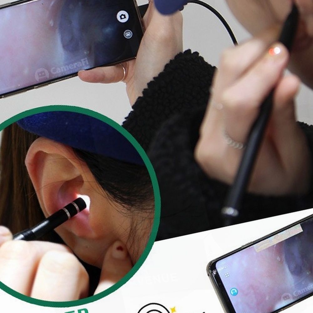 귀이개 귀청소기 귀지제거 LED 조명 내시경 귀후비개