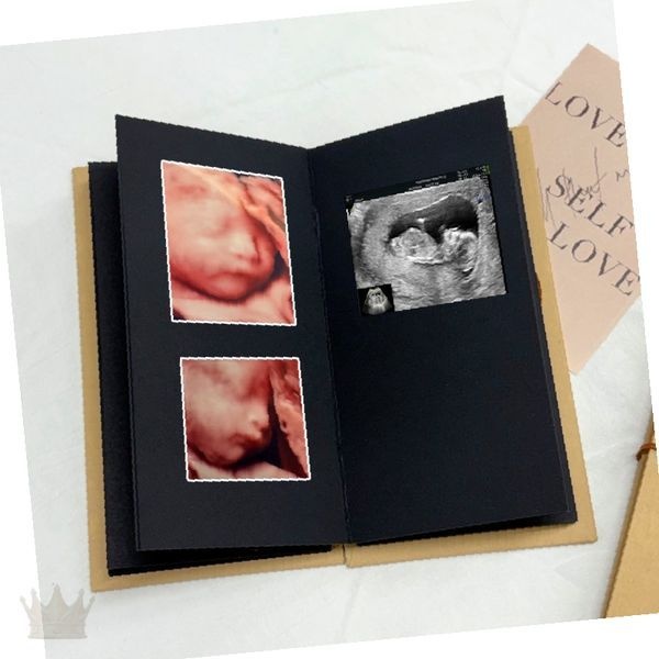 [글로벌온협력업체]임신 중 검사 결과 초음파 사진 태아 성장 과정 육아 일지 작성 접이식 다이어리