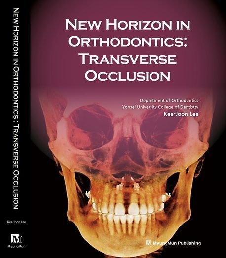 Kee-Joon Lee New Horizon in Orthodontics: Transverse Occlusion 교정학의 새 지평: 횡적 교합 (영어 원서)Kee-Joon Lee(2254218)