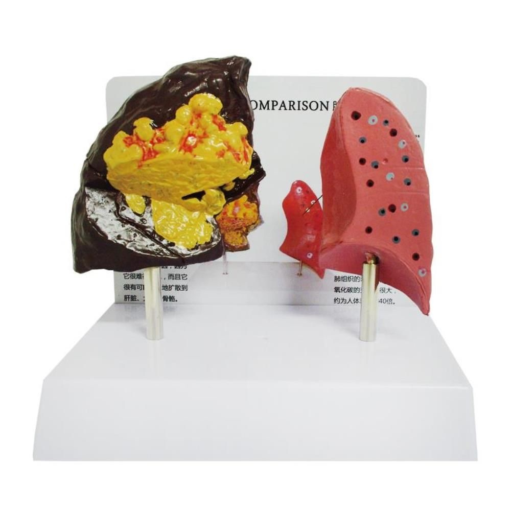 ToyScience 보건소 금연 교육 교보재 폐 인체 모형 해부학 관찰 모형재료 의대 간호사