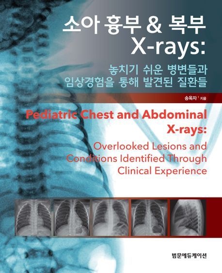 소아 흉부 복부 X-rays (놓치기 쉬운 병변들과 임상경험을 통해 발견된 질환들)송옥자(2253696)